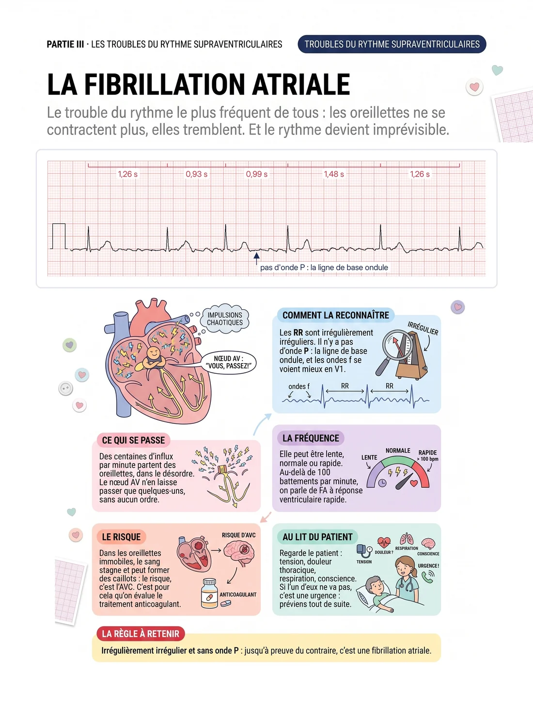 La fibrillation atriale